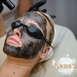 carbon-peeling-melytisztitas-porus-borhibak-csokkentese-fiatalos-bor-devai-mercedesz-nana-s-beauty-heaven-budapest-XIII-kerulet Carbon Peeling, mélytisztítás, pórus, bőrhibák csökkentése, fiatalos bőr, Dévai Mercédesz, Nana’s Beauty Heaven, Budapest, XIII kerület